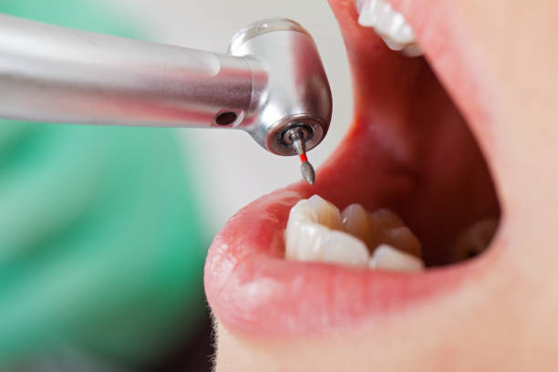 Best Emergency Dentist for Lost Fillings or Crowns in Redfield, AR